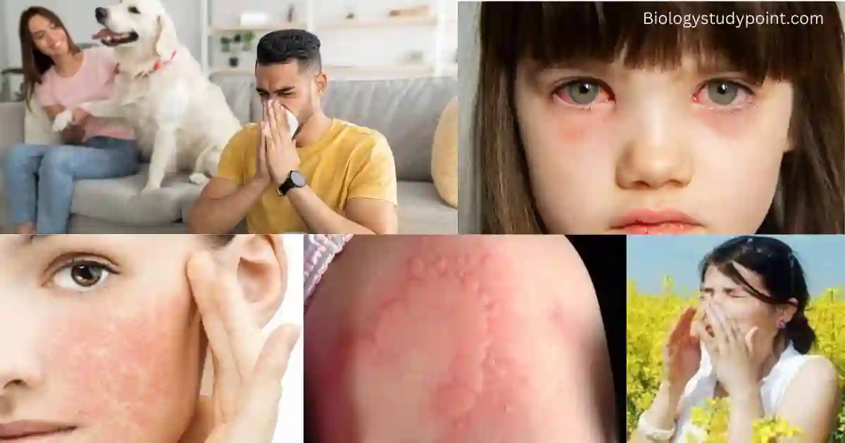 What is allergy seasons